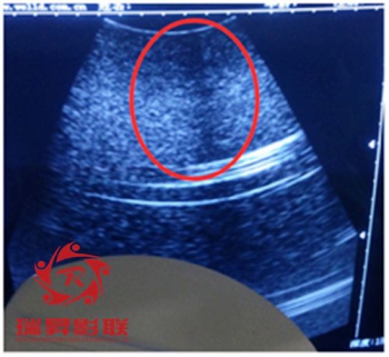 日立-阿洛卡UST-9130腹部超聲探頭維修